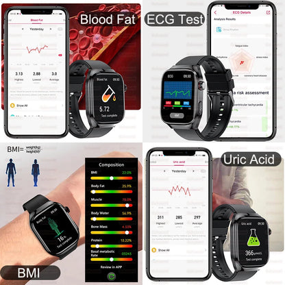 XIAOMI Health Smart Watch - ECG PPG Blood Pressure Oxygen Monitor with Bluetooth Call