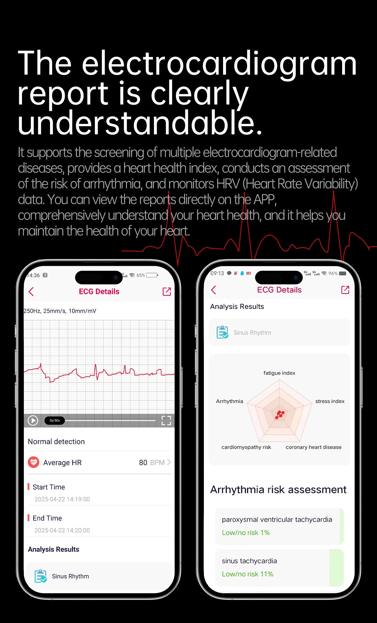 XIAOMI Health Smart Watch - ECG PPG Blood Pressure Oxygen Monitor with Bluetooth Call