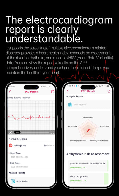 XIAOMI Health Smart Watch - ECG PPG Blood Pressure Oxygen Monitor with Bluetooth Call