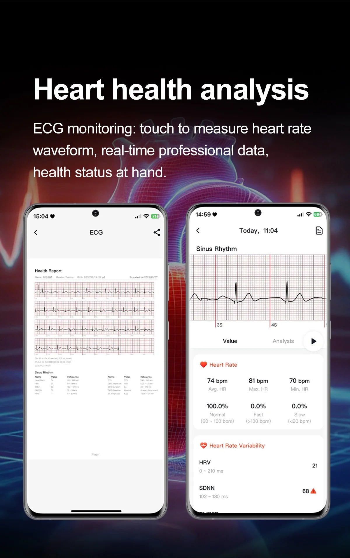 Health Smart Watch - ECG, Blood Pressure, Body Fat Analysis